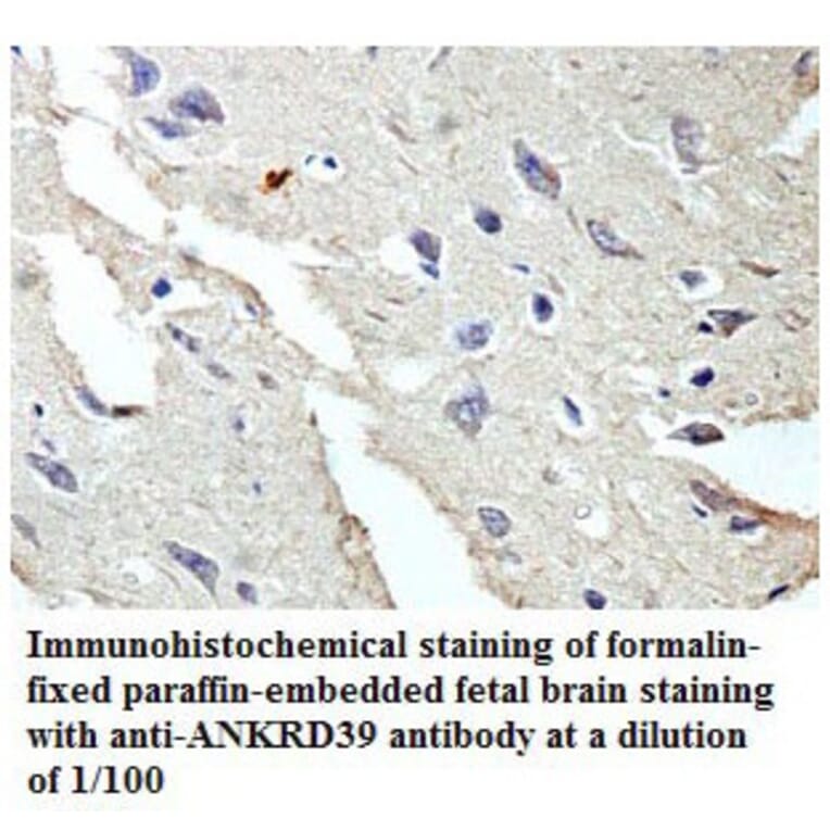 ANKRD39 Antibody from Signalway Antibody (39773) - Antibodies.com