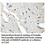 ANKRD39 Antibody from Signalway Antibody (39773) - Antibodies.com