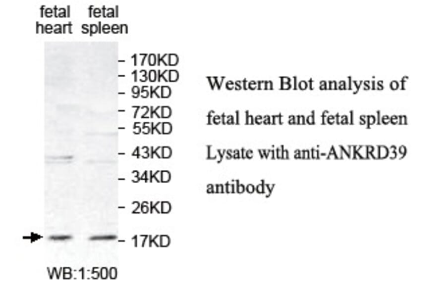 ANKRD39 Antibody from Signalway Antibody (39773) - Antibodies.com