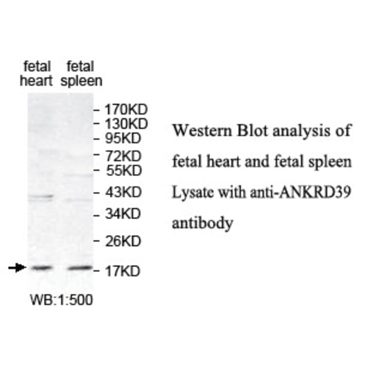 ANKRD39 Antibody from Signalway Antibody (39773) - Antibodies.com