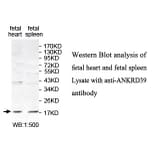 ANKRD39 Antibody from Signalway Antibody (39773) - Antibodies.com