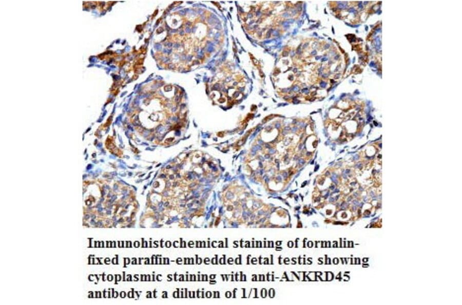 ANKRD45 Antibody from Signalway Antibody (39775) - Antibodies.com