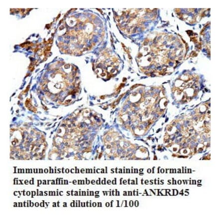 ANKRD45 Antibody from Signalway Antibody (39775) - Antibodies.com