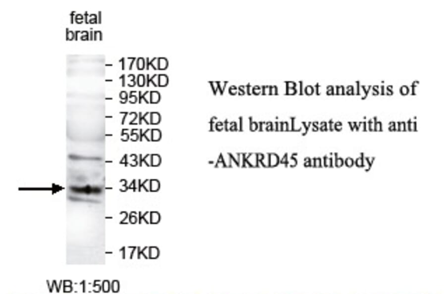 ANKRD45 Antibody from Signalway Antibody (39775) - Antibodies.com