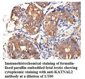KATNAL2 Antibody from Signalway Antibody (39776) - Antibodies.com