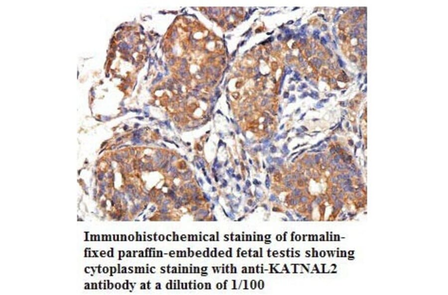 KATNAL2 Antibody from Signalway Antibody (39776) - Antibodies.com
