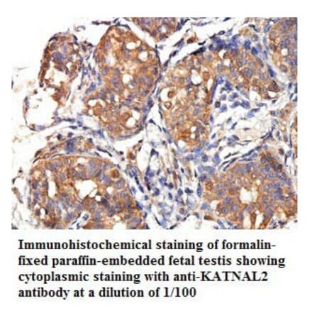 KATNAL2 Antibody from Signalway Antibody (39776) - Antibodies.com