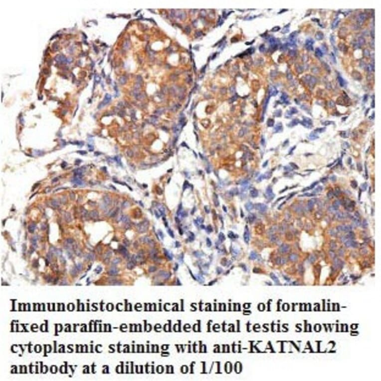 KATNAL2 Antibody from Signalway Antibody (39776) - Antibodies.com