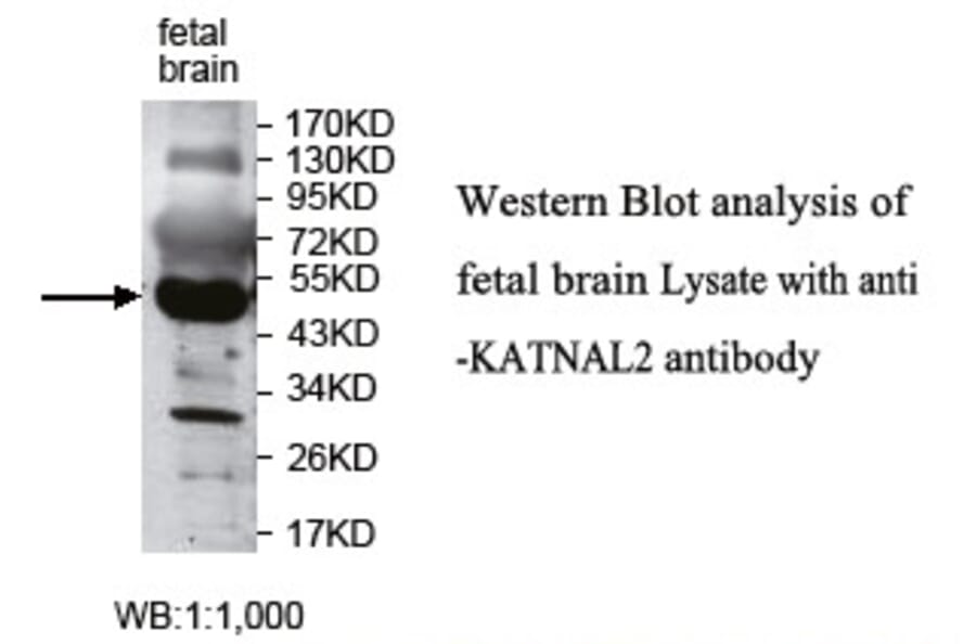 KATNAL2 Antibody from Signalway Antibody (39776) - Antibodies.com