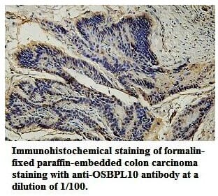 Anti-OSBPL10 Antibody