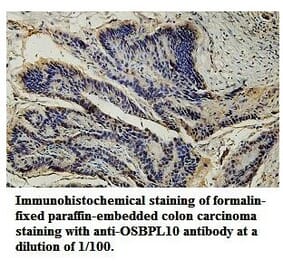 OSBPL10 Antibody from Signalway Antibody (39777) - Antibodies.com