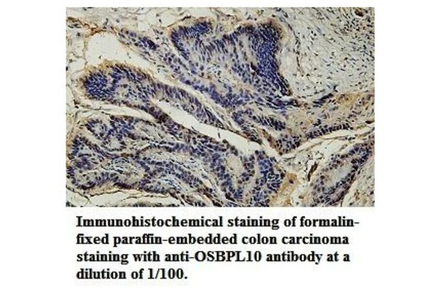 OSBPL10 Antibody from Signalway Antibody (39777) - Antibodies.com