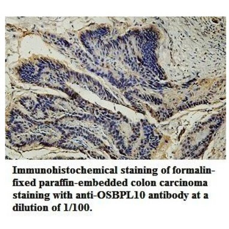 OSBPL10 Antibody from Signalway Antibody (39777) - Antibodies.com
