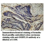 OSBPL10 Antibody from Signalway Antibody (39777) - Antibodies.com