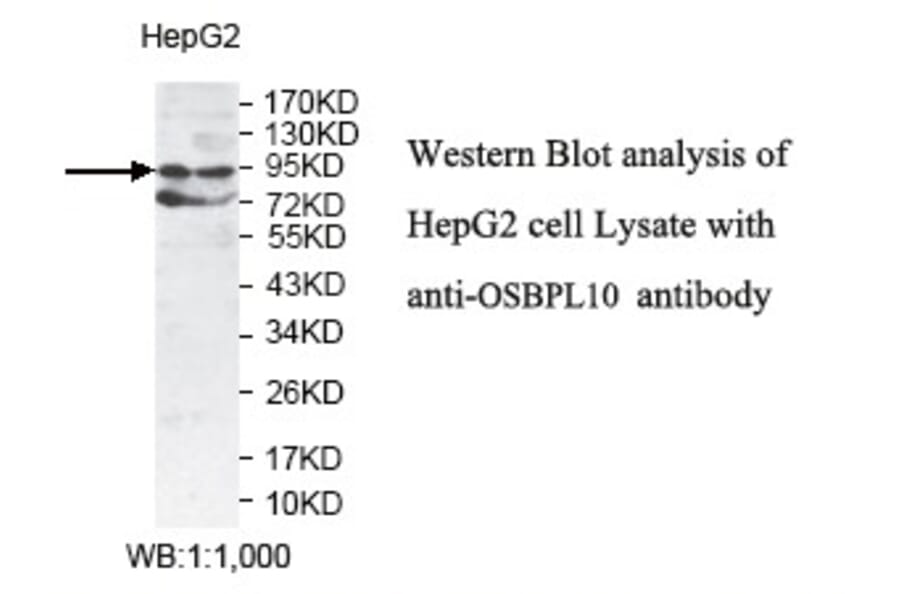 OSBPL10 Antibody from Signalway Antibody (39777) - Antibodies.com