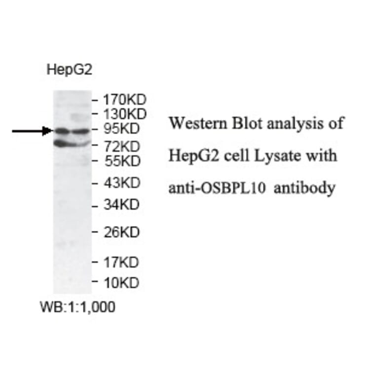 OSBPL10 Antibody from Signalway Antibody (39777) - Antibodies.com