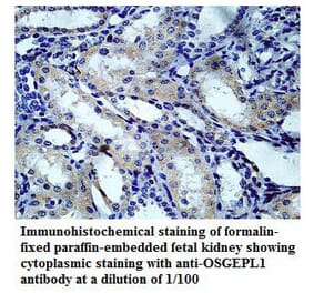 OSGEPL1 Antibody from Signalway Antibody (39782) - Antibodies.com