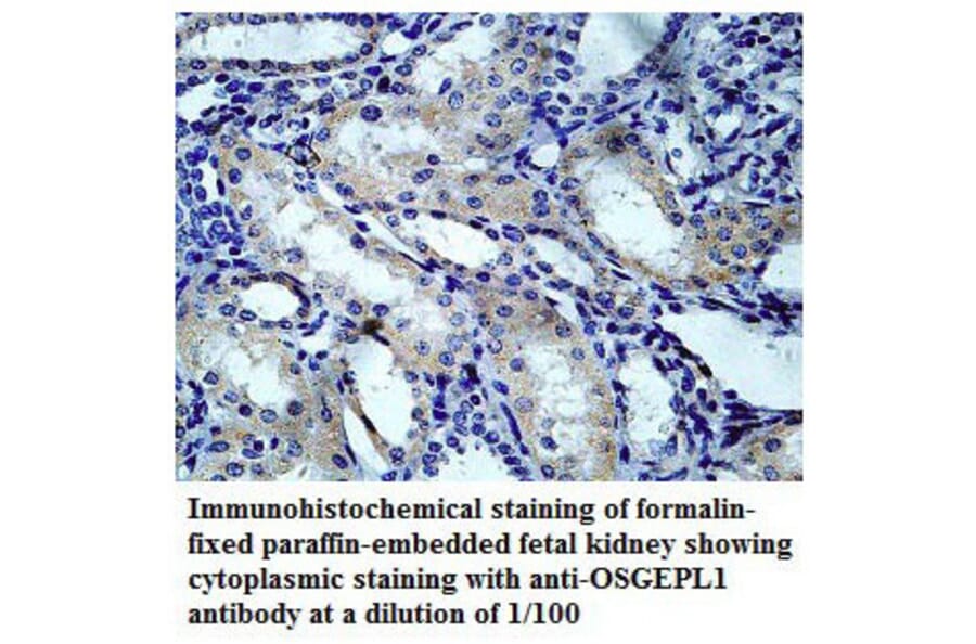 OSGEPL1 Antibody from Signalway Antibody (39782) - Antibodies.com