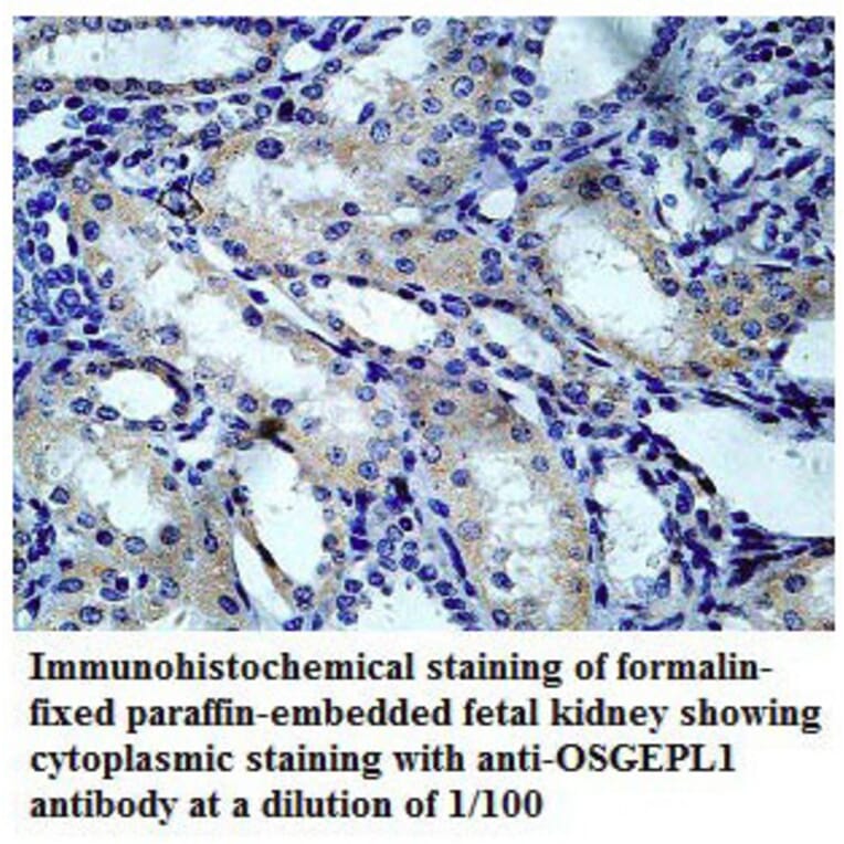 OSGEPL1 Antibody from Signalway Antibody (39782) - Antibodies.com