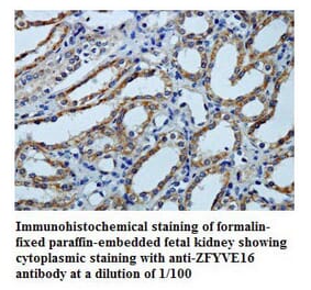 ZFYVE16 Antibody from Signalway Antibody (39790) - Antibodies.com