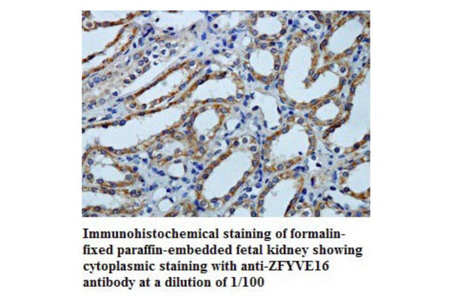 ZFYVE16 Antibody from Signalway Antibody (39790) - Antibodies.com