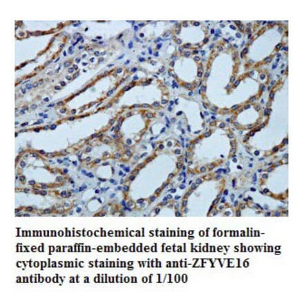 ZFYVE16 Antibody from Signalway Antibody (39790) - Antibodies.com