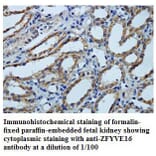 ZFYVE16 Antibody from Signalway Antibody (39790) - Antibodies.com