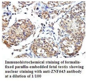 PLEKHJ1 Antibody from Signalway Antibody (39793) - Antibodies.com