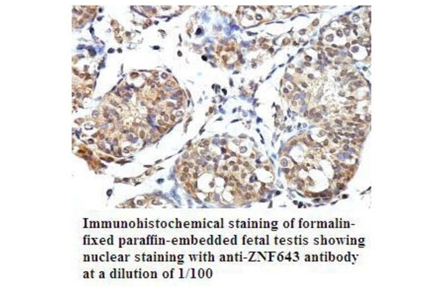 PLEKHJ1 Antibody from Signalway Antibody (39793) - Antibodies.com