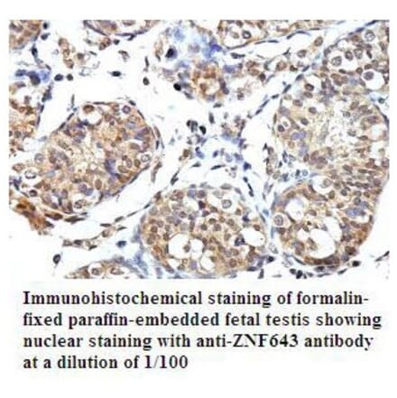 PLEKHJ1 Antibody from Signalway Antibody (39793) - Antibodies.com
