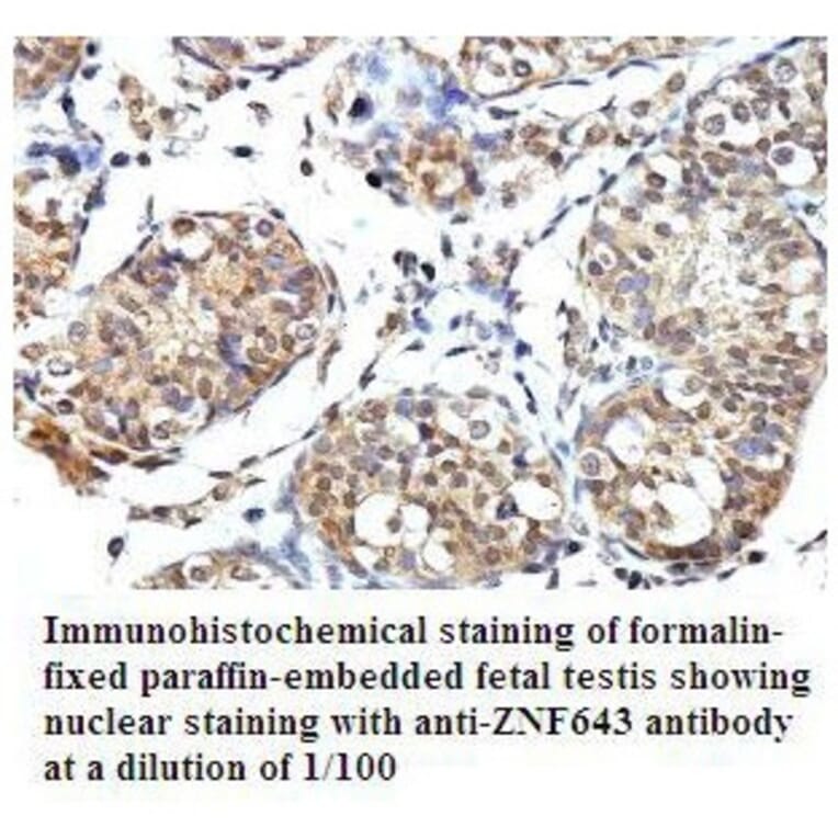 PLEKHJ1 Antibody from Signalway Antibody (39793) - Antibodies.com