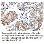 PLEKHJ1 Antibody from Signalway Antibody (39793) - Antibodies.com