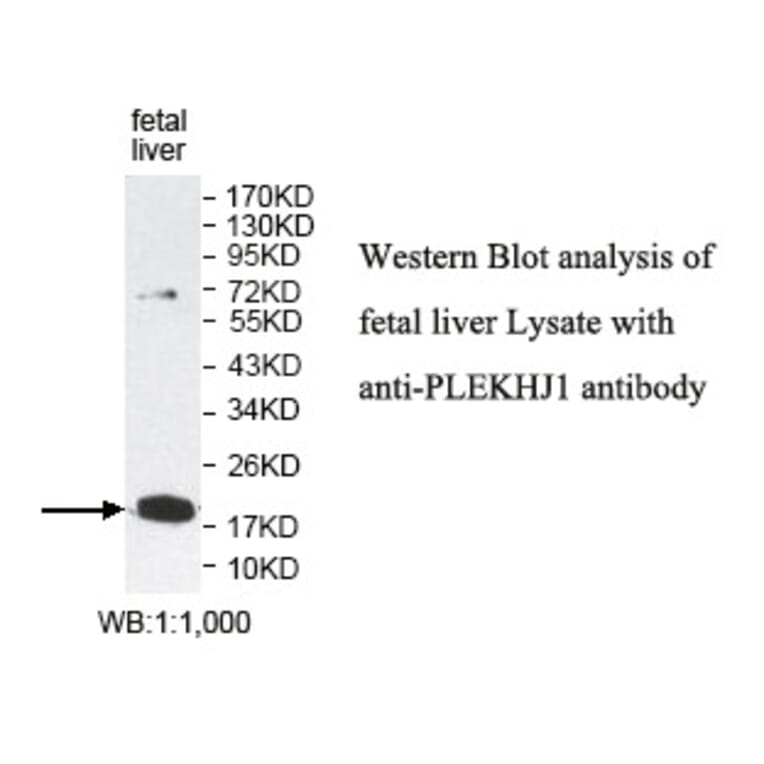 PLEKHJ1 Antibody from Signalway Antibody (39793) - Antibodies.com