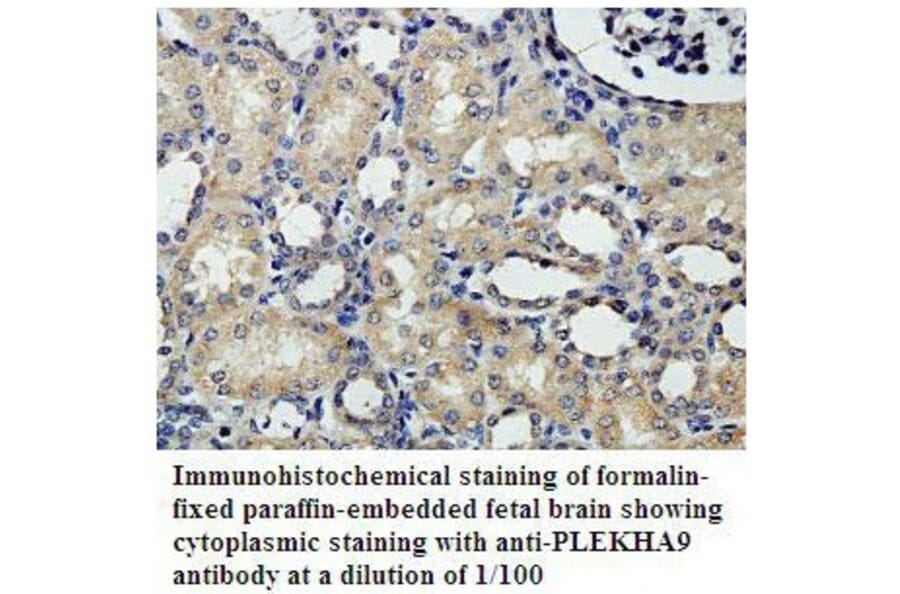 PLEKHA9 Antibody from Signalway Antibody (39807) - Antibodies.com
