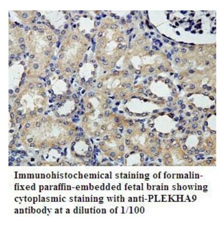PLEKHA9 Antibody from Signalway Antibody (39807) - Antibodies.com