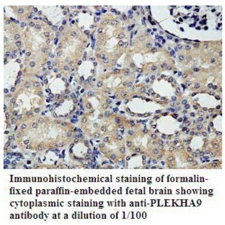 PLEKHA9 Antibody from Signalway Antibody (39807) - Antibodies.com
