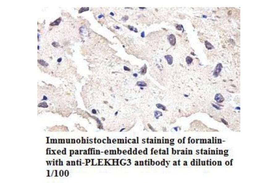 PLEKHG3 Antibody from Signalway Antibody (39808) - Antibodies.com