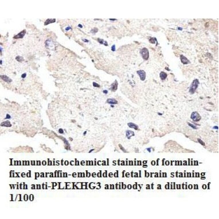 PLEKHG3 Antibody from Signalway Antibody (39808) - Antibodies.com