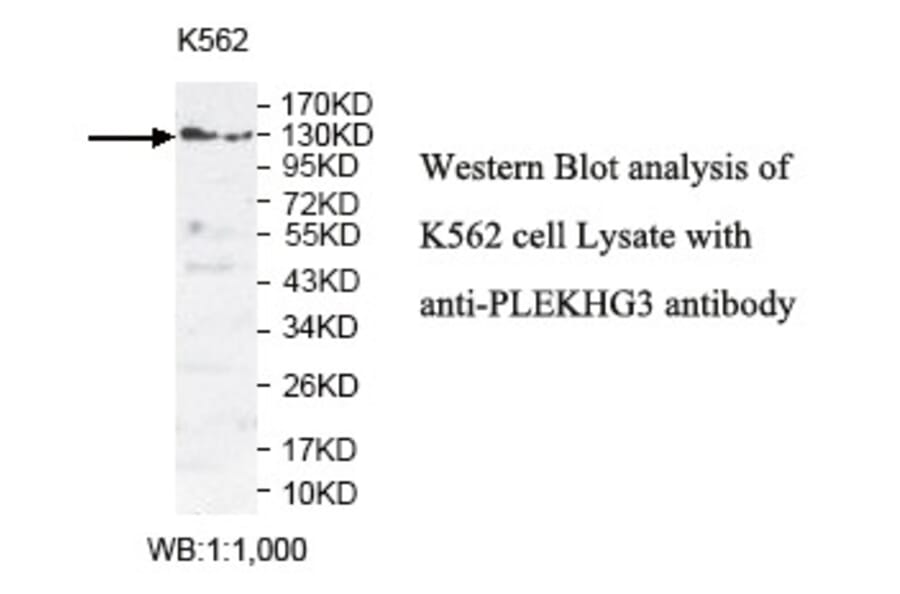 PLEKHG3 Antibody from Signalway Antibody (39808) - Antibodies.com