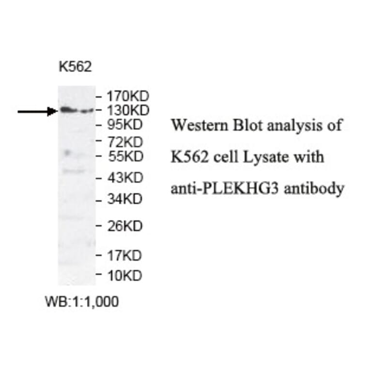 PLEKHG3 Antibody from Signalway Antibody (39808) - Antibodies.com