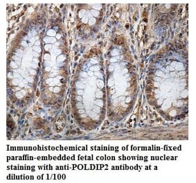 POLDIP2 Antibody from Signalway Antibody (39856) - Antibodies.com