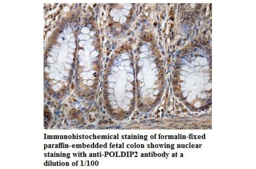 POLDIP2 Antibody from Signalway Antibody (39856) - Antibodies.com