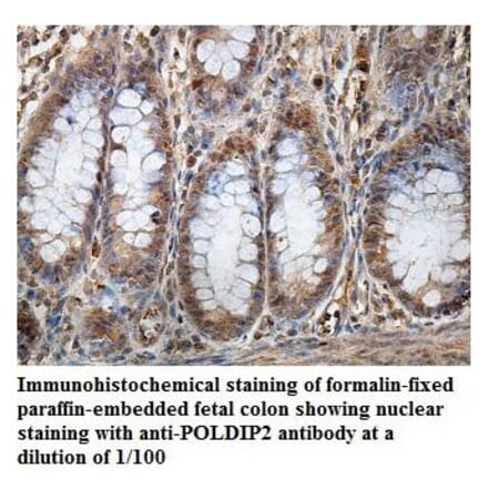 POLDIP2 Antibody from Signalway Antibody (39856) - Antibodies.com