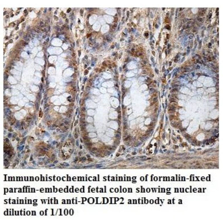 POLDIP2 Antibody from Signalway Antibody (39856) - Antibodies.com