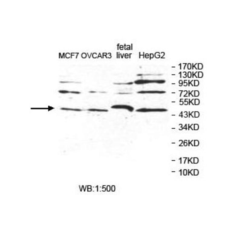 POLDIP2 Antibody from Signalway Antibody (39856) - Antibodies.com