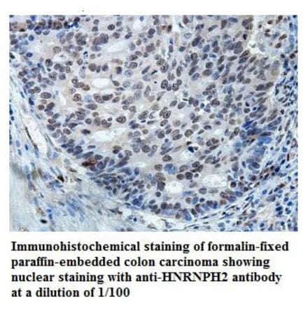 HNRNPH2 Antibody from Signalway Antibody (39873) - Antibodies.com