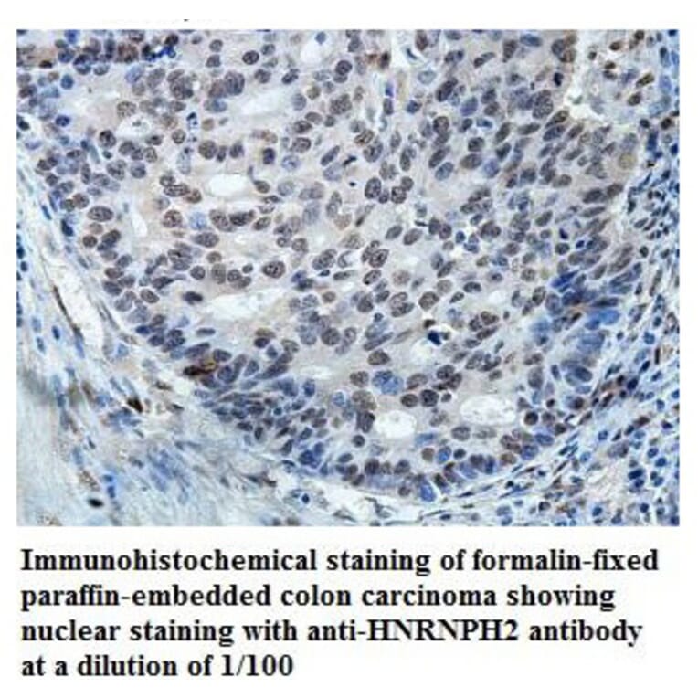 HNRNPH2 Antibody from Signalway Antibody (39873) - Antibodies.com