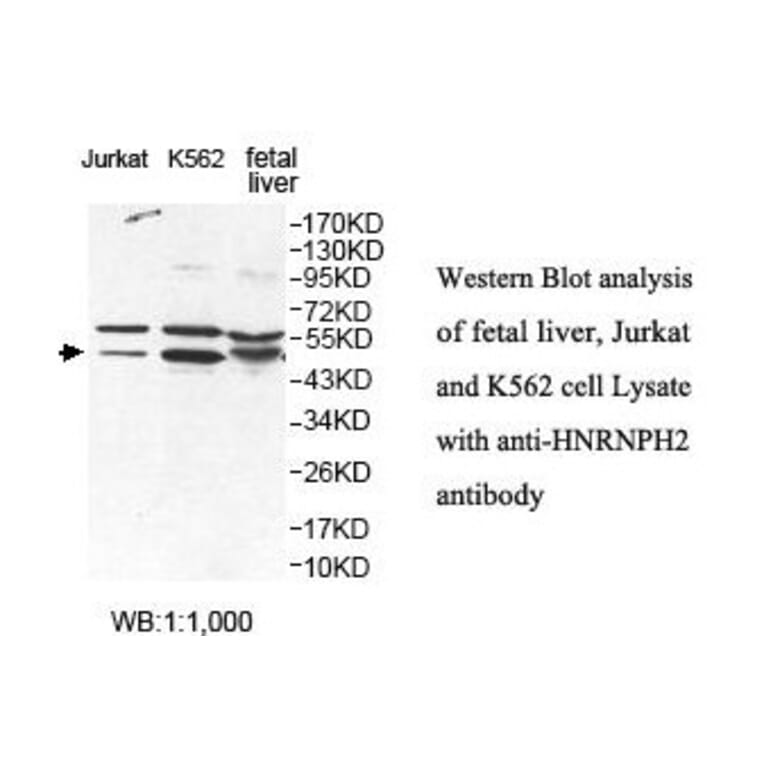 HNRNPH2 Antibody from Signalway Antibody (39873) - Antibodies.com