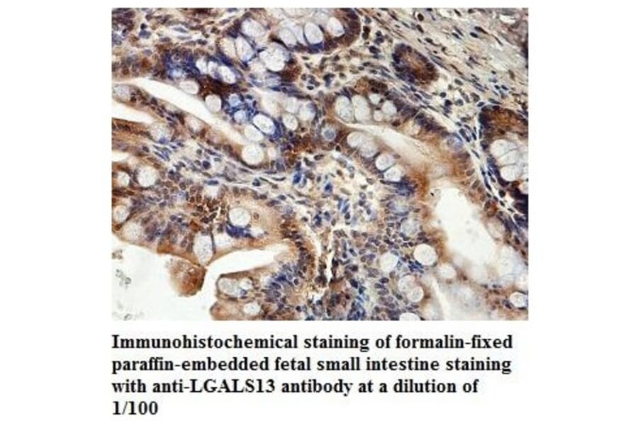 LGALS13 Antibody from Signalway Antibody (39876) - Antibodies.com