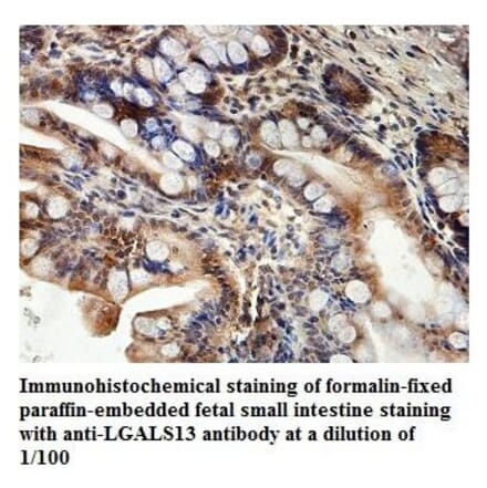 LGALS13 Antibody from Signalway Antibody (39876) - Antibodies.com